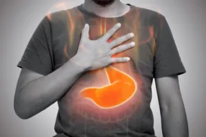 acid reflux heartburn