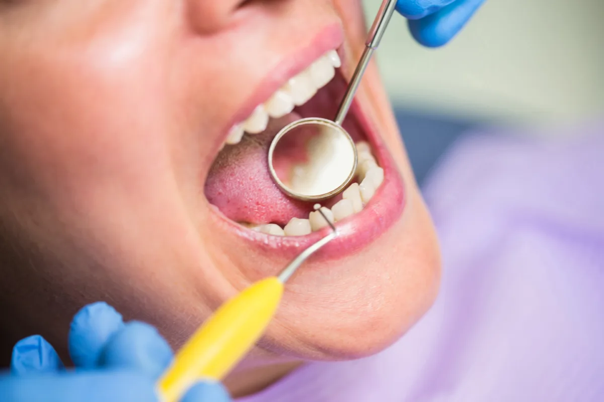 dentist examining female patient teeth