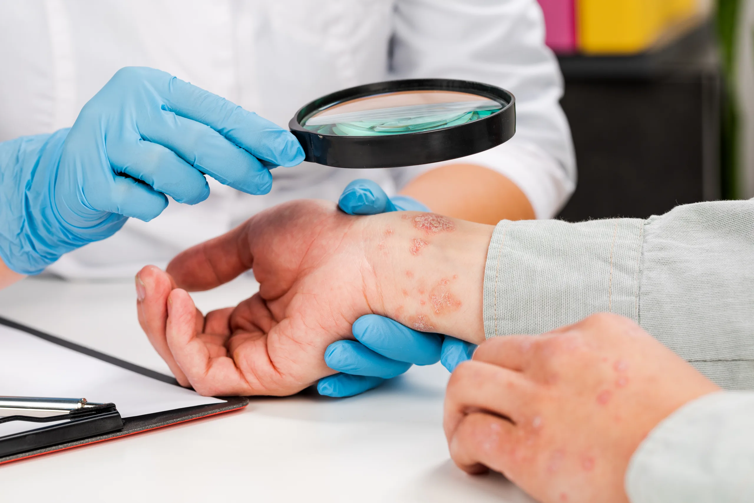 dermatologist wearing gloves examines skin sick patient examination diagnosis skin diseasesallergies psoriasis eczema dermatitis scaled