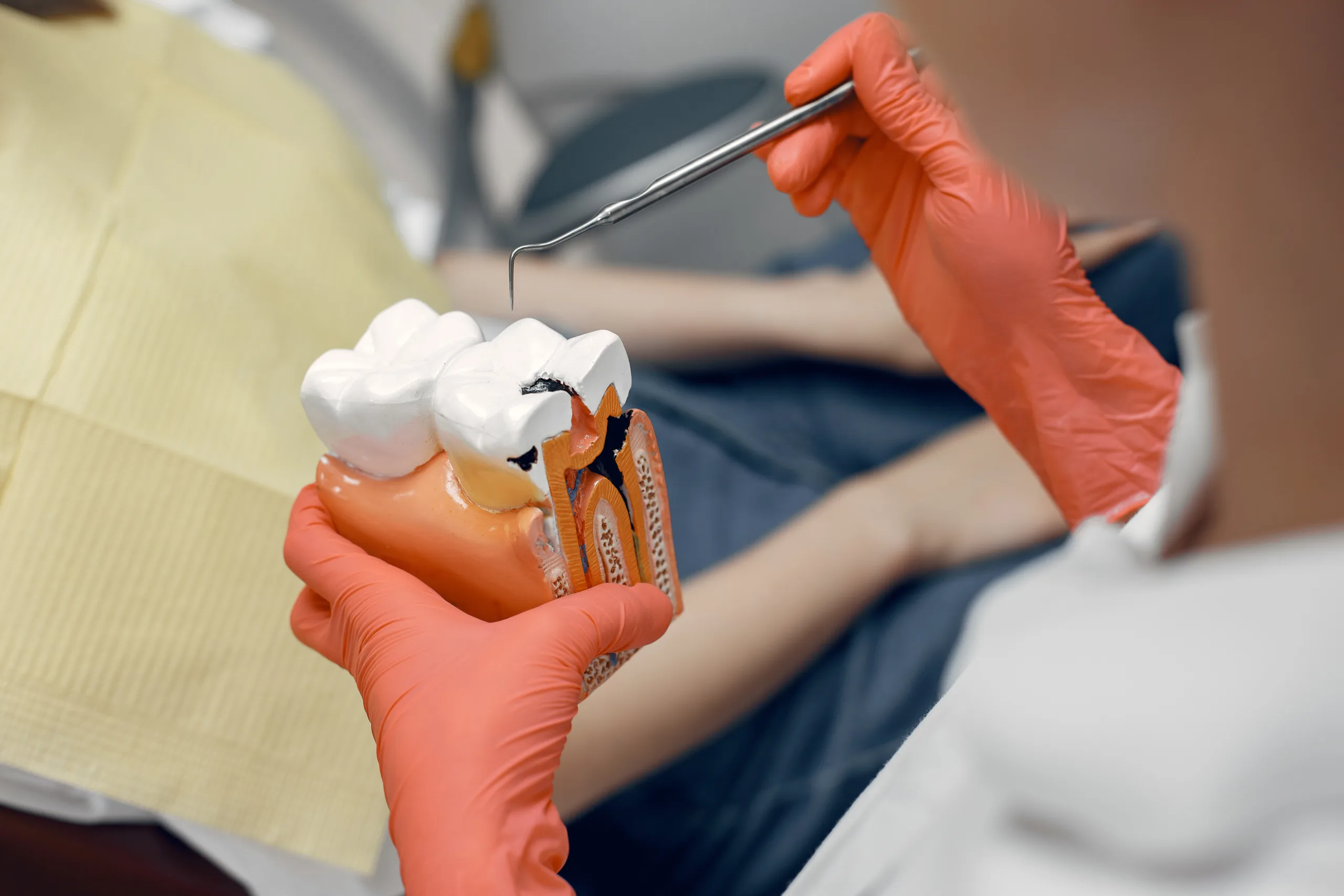 model tooth dentist doctor shows patient tooth reception dentist s office 1 scaled