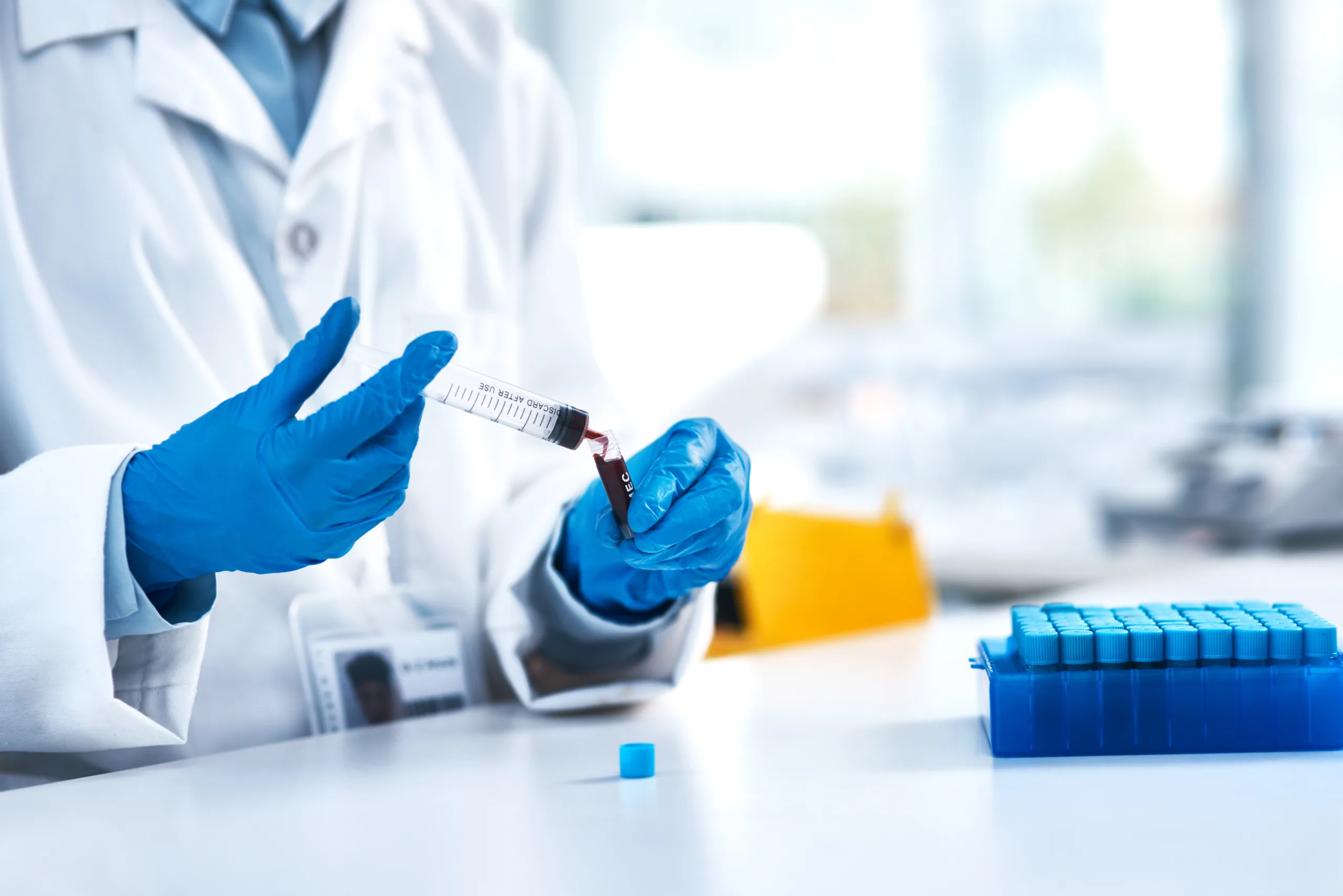 science blood sample hands with syringe laboratory investigation research testing biotechnology pharmaceutical person with test tube analysis experiment medical study scaled