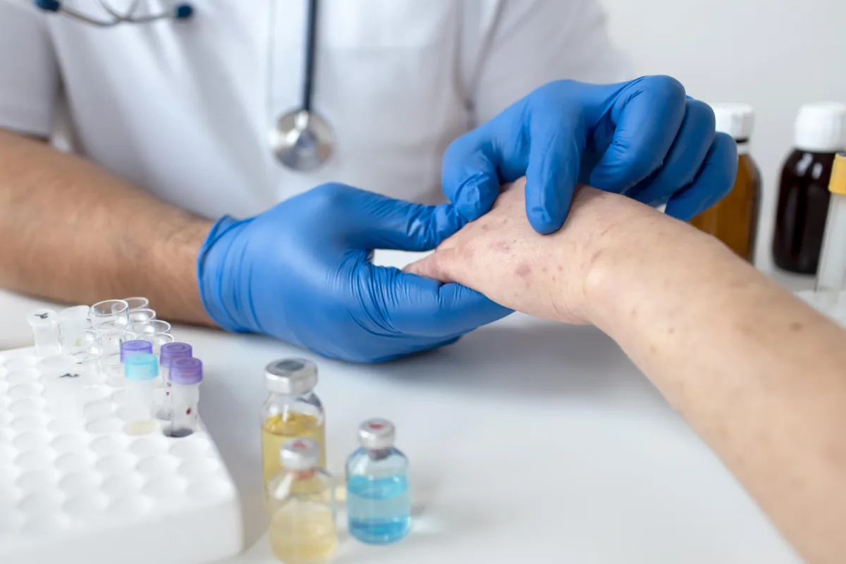 skin allergy person s arm